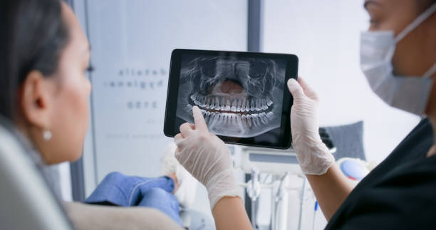 Licensed Teeth Cleaning And Checkup service in Springtown, TX - Smile Center Dentistry